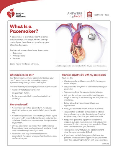 Hoja de respuestas del corazón: qué es un marcapasos
