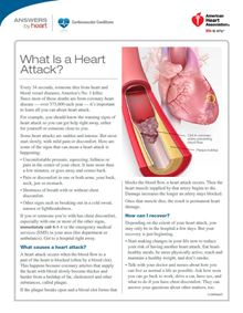 Hoja informativa sobre el ataque al corazón