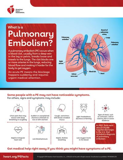 What is a pullmonary embolism fact sheet