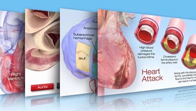 WLLWidget1 Interactive Cardiovascular Library Thumbnail image