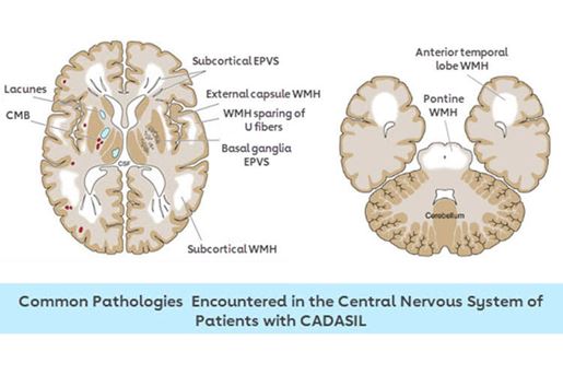 common pathologies encountered in the central nervous system